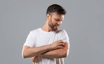 The Best Clothing for Eczema: How to Choose Comfort and Relief Clothing for Eczema