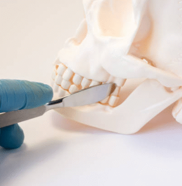 Signs You Need More Than a Simple Tooth Extraction Tooth Extraction